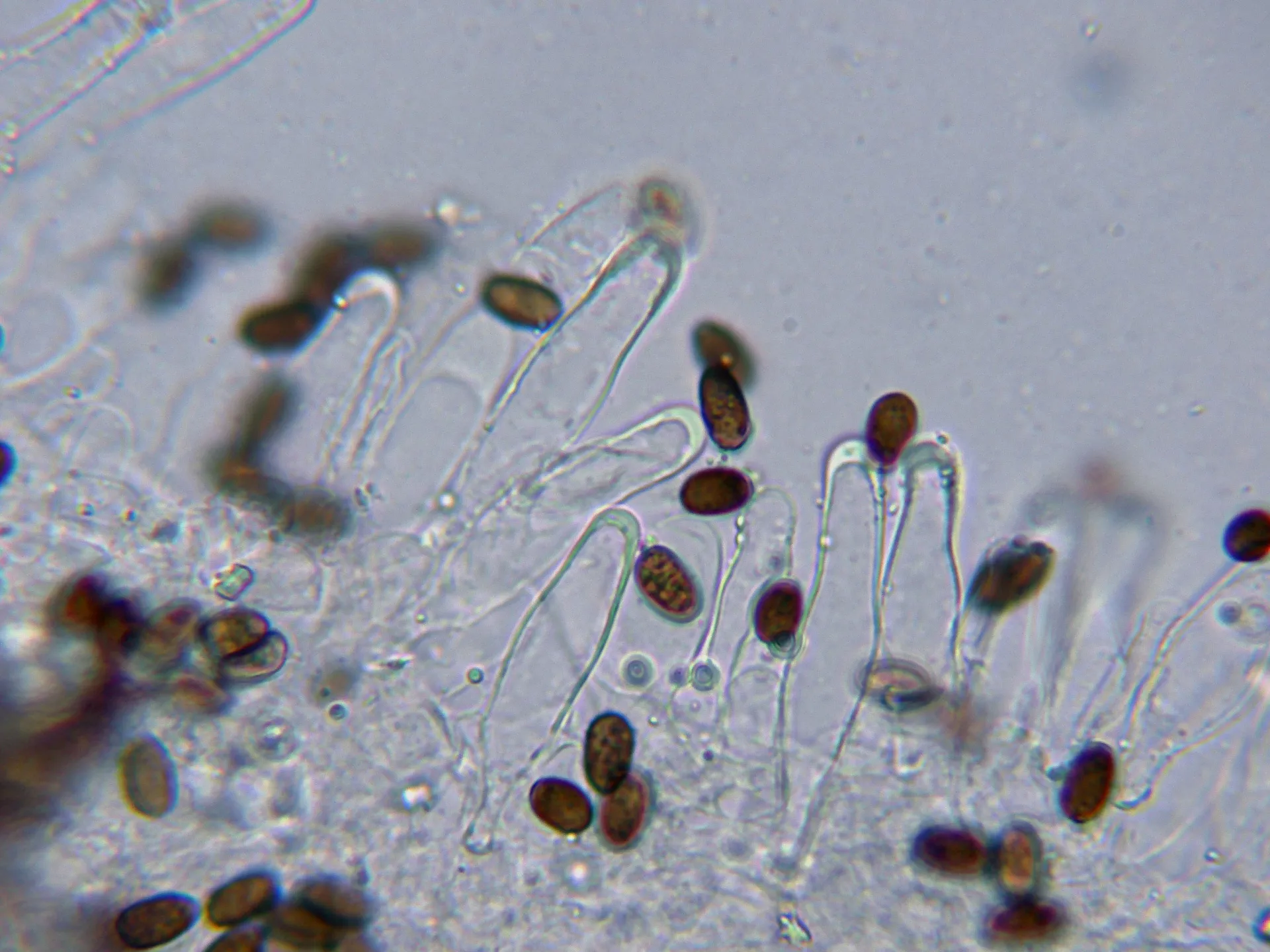 Microscopía de Psathyrella tephrophylla - 10 - Queilocistidios joven amoníaco-002